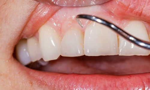 PERIODONCIA (1)