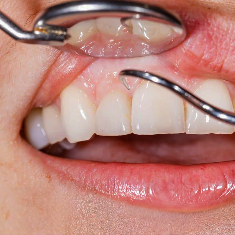 PERIODONCIA (1)